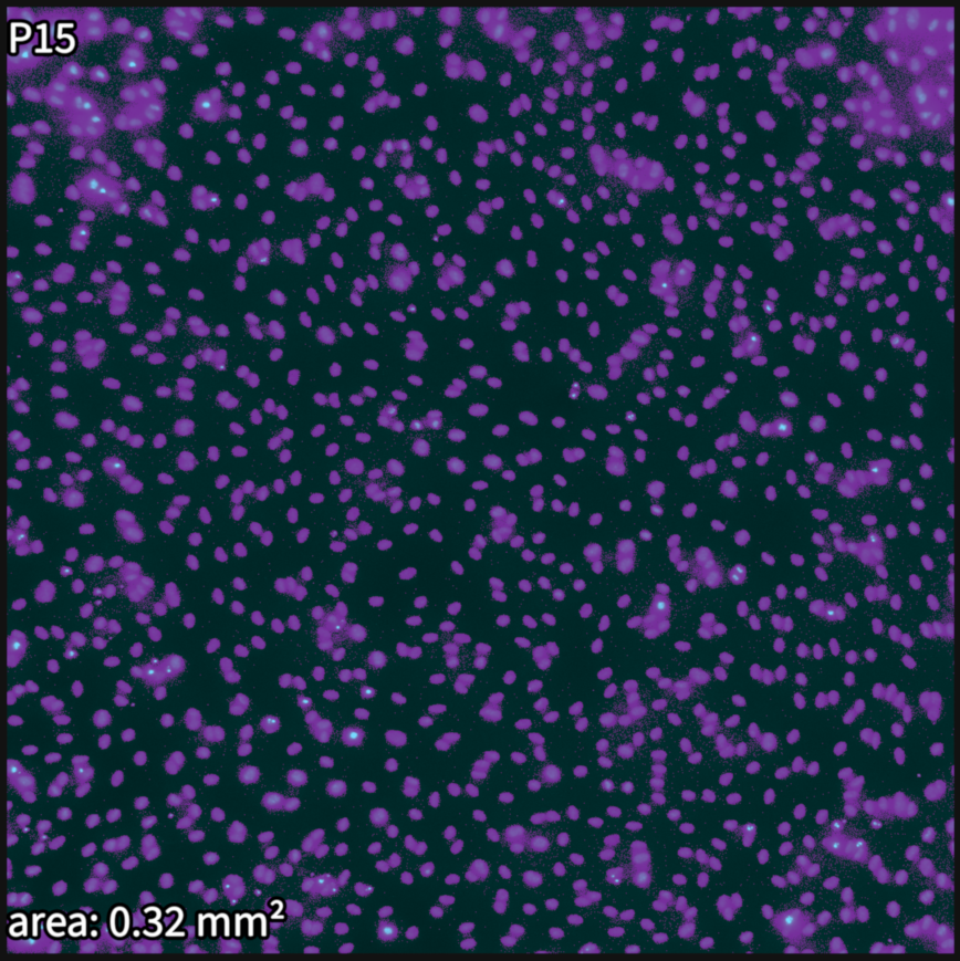 Figure 61